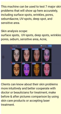 Nubway Face Analyzer Laser Machine